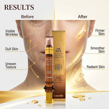 Lamelin 24k Gold Placenta Wrinkle Corrector